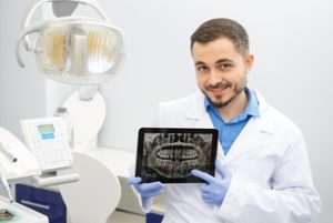 Cost Of Dental Implants In Australia procedure bella vista